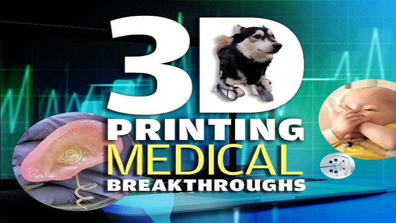 3D Printing Medical Breakthroughs