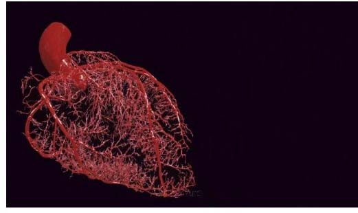 Coronary Microvasculature 300x300 2