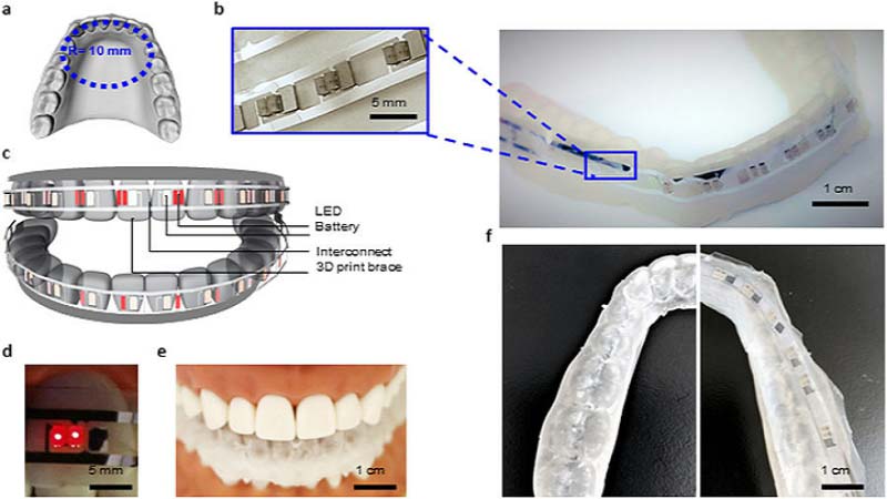 Smart Braces LED Battery