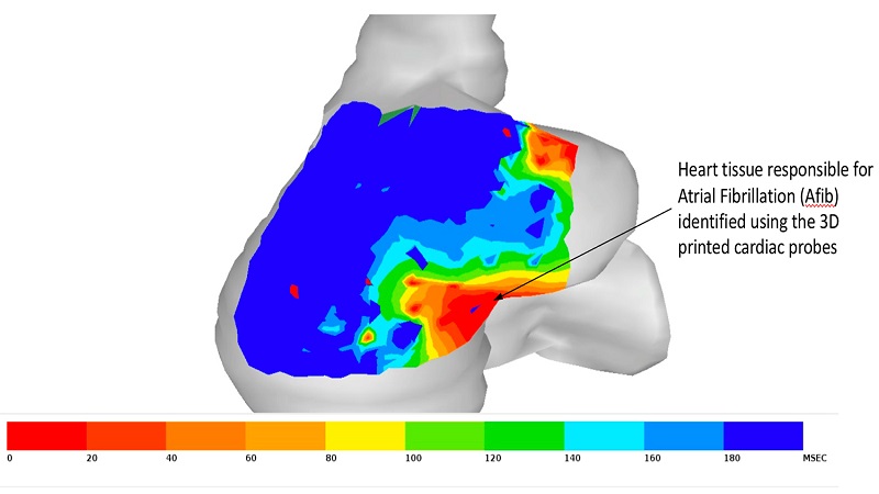 3D Printed Cardiac Catheter Devices Can Save Lives With Precision