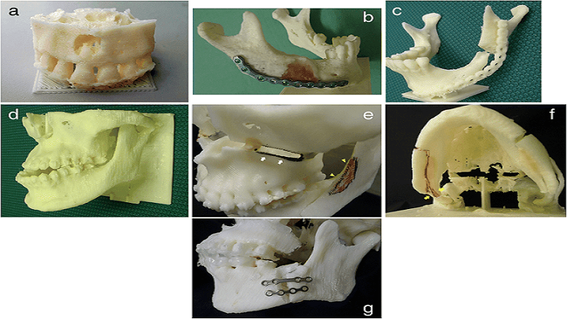 Tokyo Researchers Reduce Production Costs For 3D Printed Medical Models