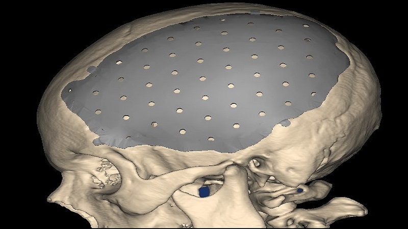 BioArchitect Continues To Harvest 3D Printing Technology