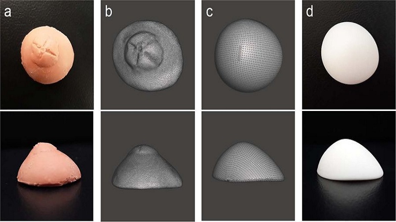 3D Printing The Realistic Custom Eye Prosthetics