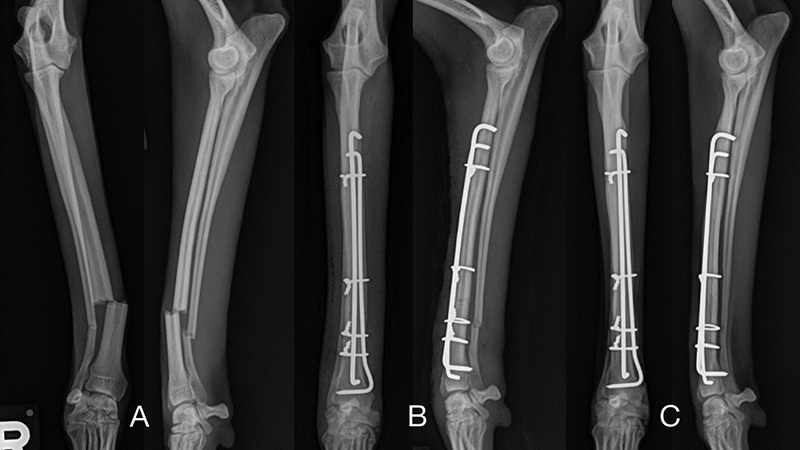 Randomized Trial By Chinese Researchers Prove Potential Of 3D Printed Models In Orthopedics Management