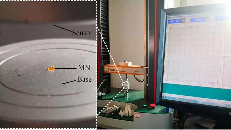 DLP 3D Printed Microneedles For Improved Performance In Clinical Uses