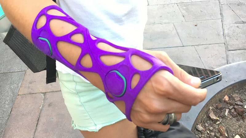 3D 3D-Printed Orthopedic Cast Hand Blue - TurboSquid 1900338