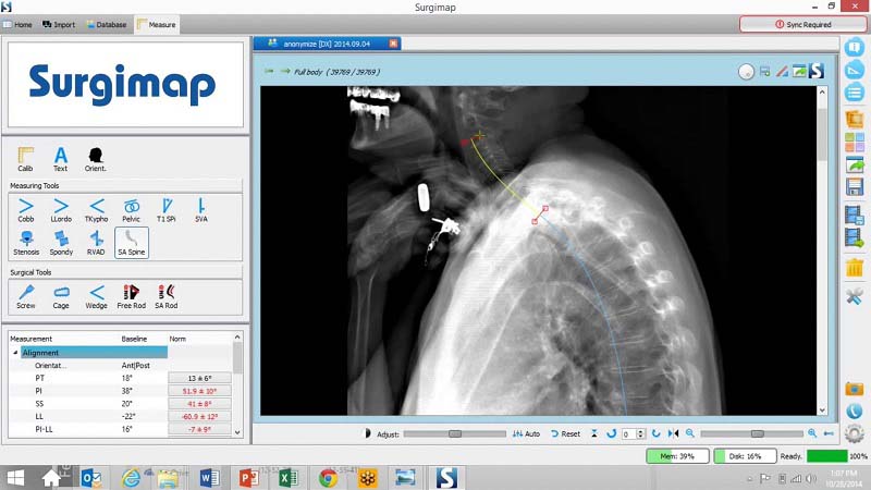 Medicrea Unid Cervical Rod