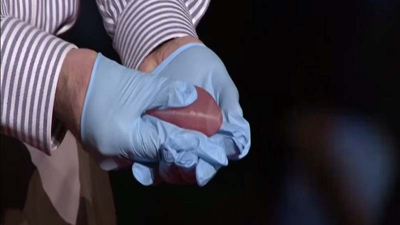 3D Print Human Kidney