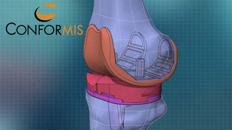 conformis 800x450