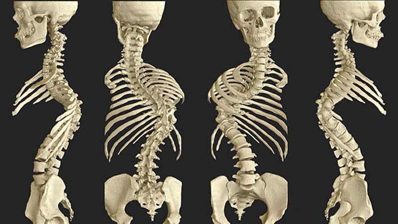 Osteo3d models 800x450