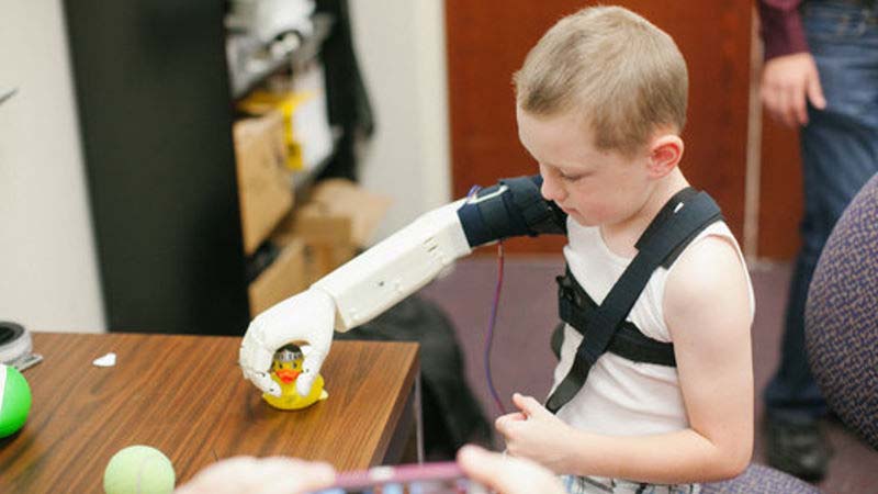 bionic arm 800x450