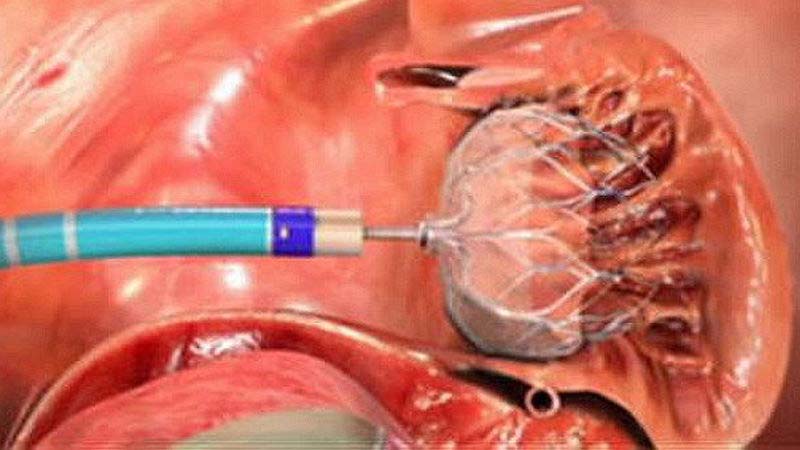 cardiologist heart model 800x450