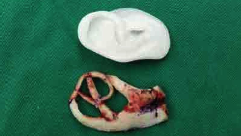 ear model 800x450