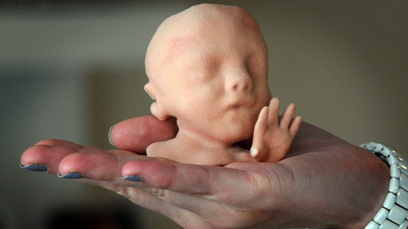 fetus 800x450