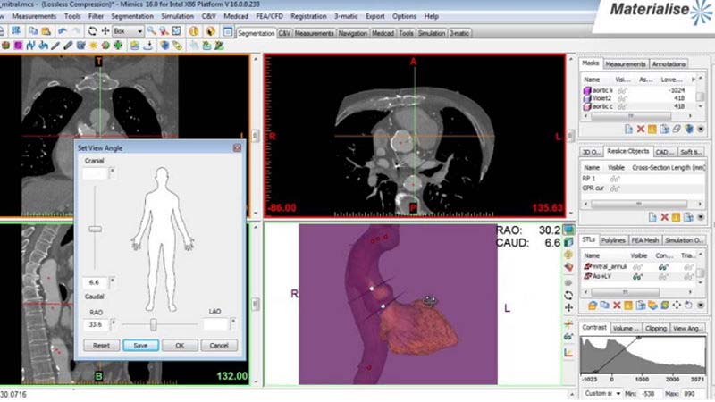 materialize bio software 800x450