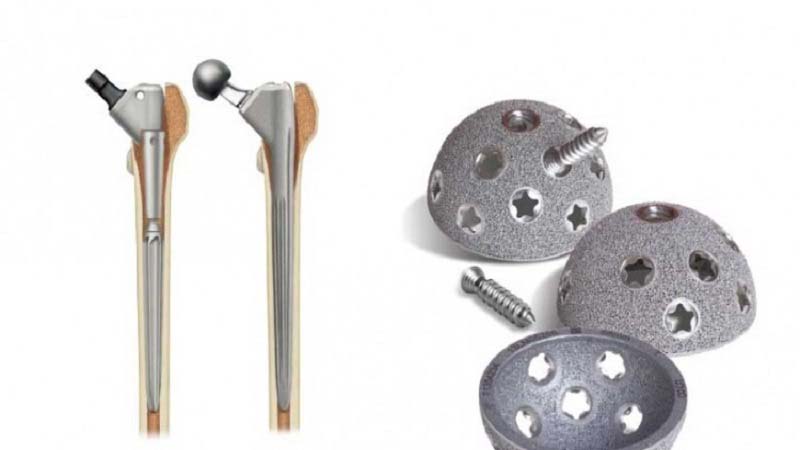 Smith and Nephew RedApt Titanium Hip Implant